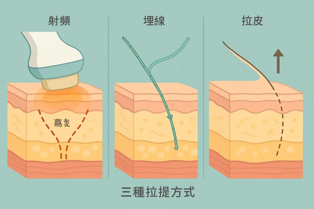 鳳凰電波療程流程與痛感管理